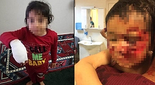 Şanlıurfa'da dehşet! 6 çocuğu paramparça ettiler: 3'ünün durumu ağır