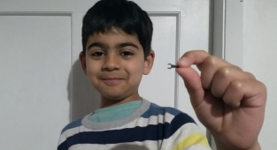 7 yaşındaki çocuğun burnuna sıkışan Lego parçası 2 sene sonra düştü