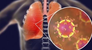 Koronavirüs: Hollandalı bilim insanlarına göre iyileşen Covid-19 hastalarında bir yıl içinde yeniden virüs görülebiliyor